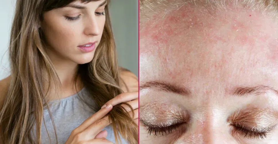 C Vitamini Eksikliği: 7 Ciddi Sağlık Sorunu
