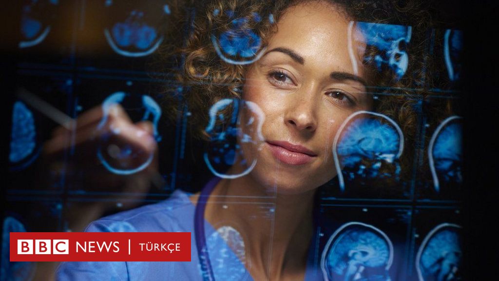 Yeni Geliştirilen İlaç Alzheimer Tedavisinde Umut Veriyor