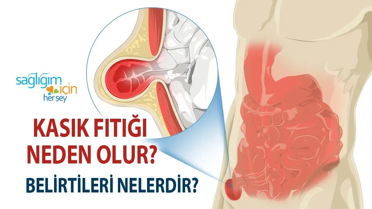 Kasık Fıtığı: Çocuklarda Yaygın Sorun ve Çözüm Yolları