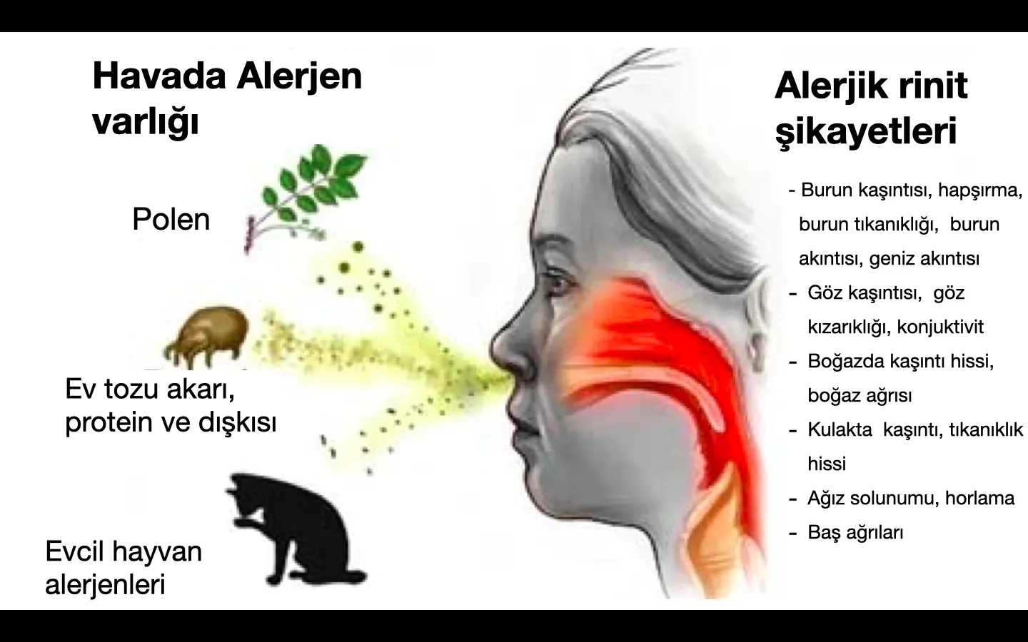 Alerjik Rinit: Bahar Nezlesinden Korunma Yolları