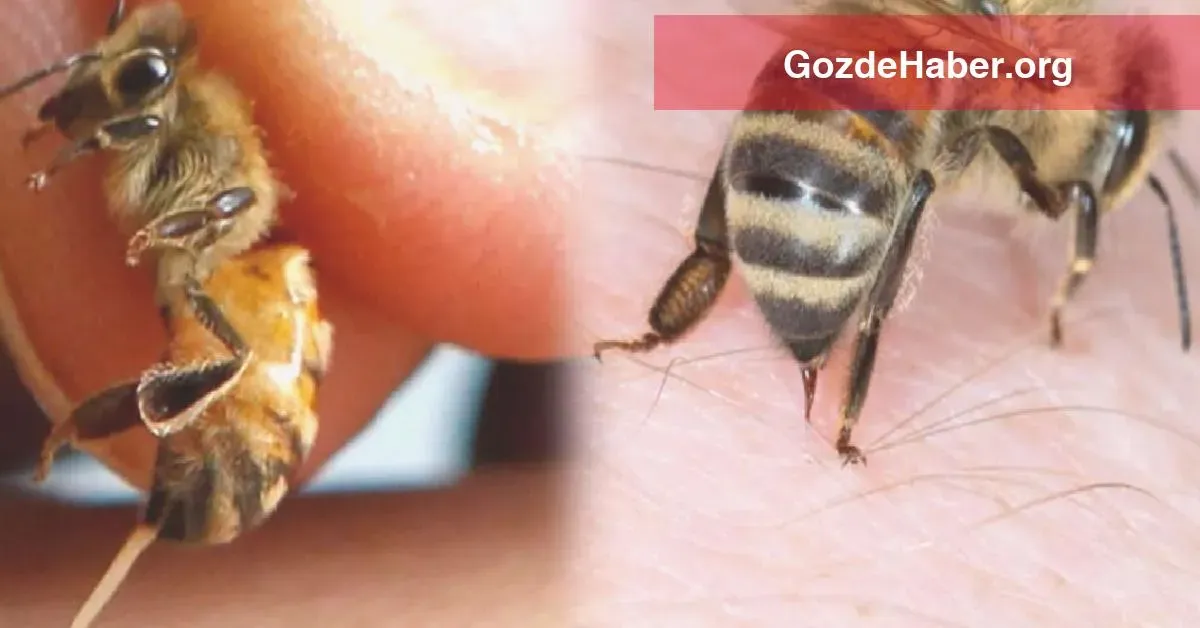 Arı Sokmaları Alerjisi: Tehlikeleri ve Önlemleri
