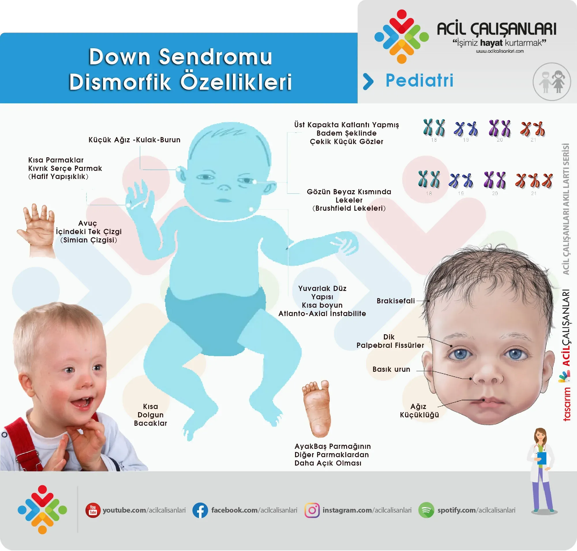 Down Sendromu: Japonların Gen Düzenlemedeki Başarısı