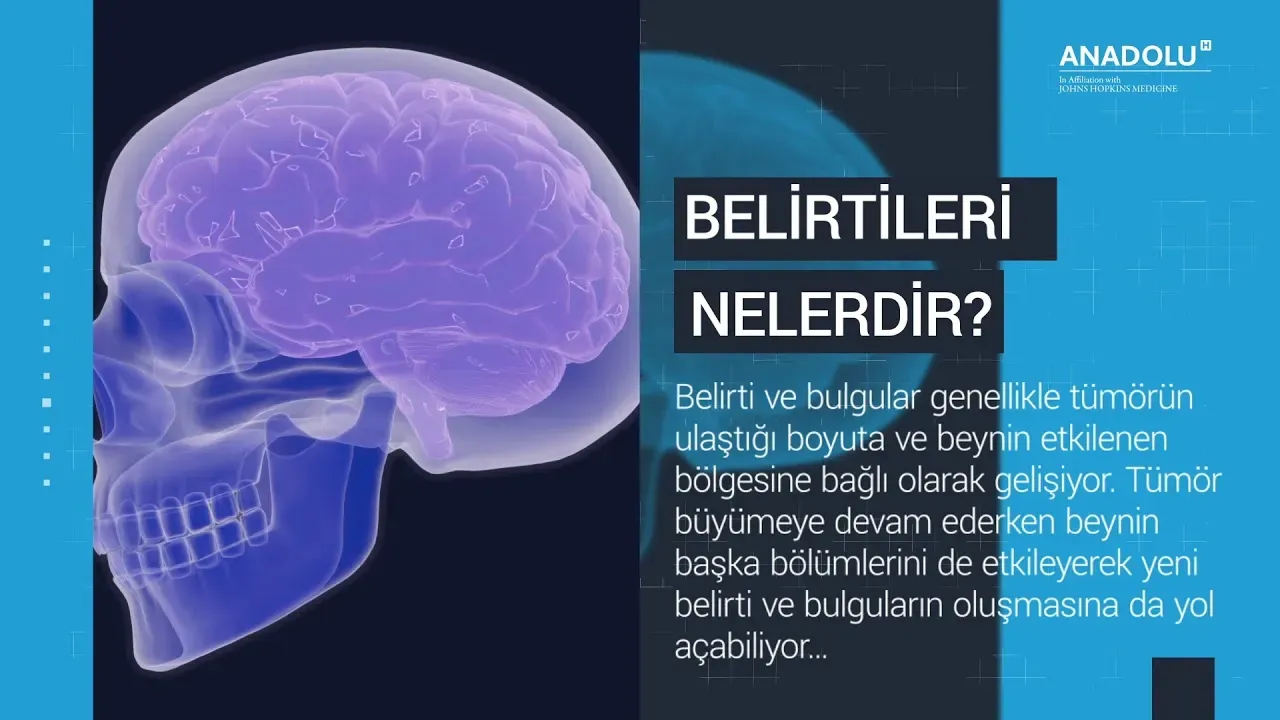 Beyin Tümörü Belirtileri: 5 Gizli İşaret