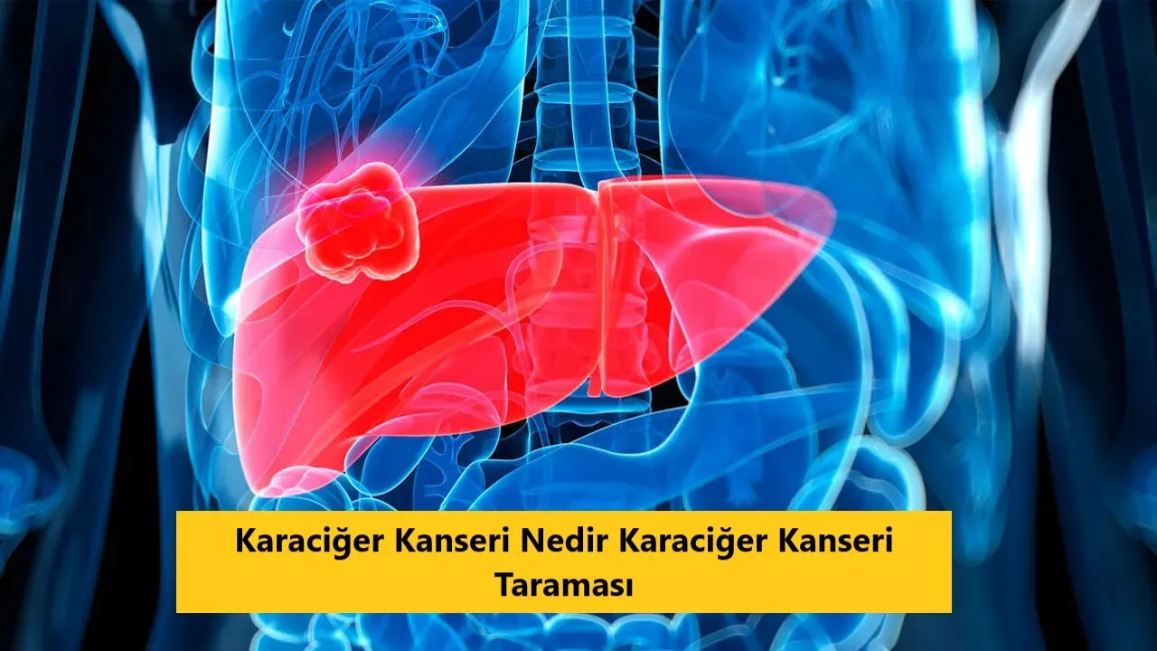 Karaciğer Kanseri: Erken Teşhis ile Hayat Kurtarın