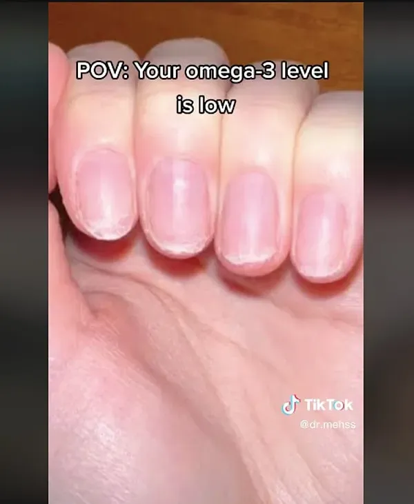 Omega-3 Yağ Asidi Eksikliği Belirtileri ve Sağlık Faydaları