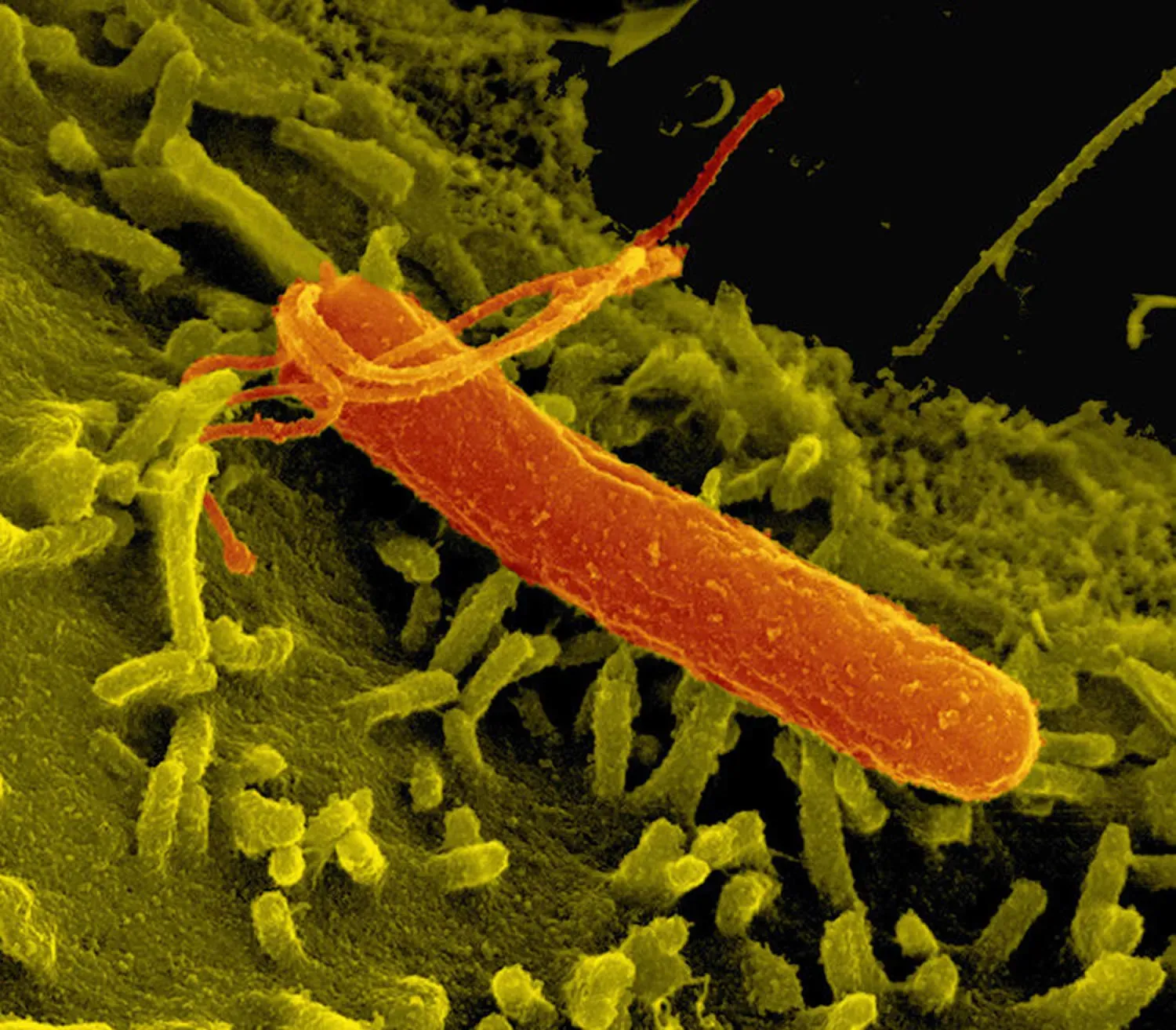 Helicobacter Pylori: Sağlığınızı Tehdit Eden Kötü Bakteri