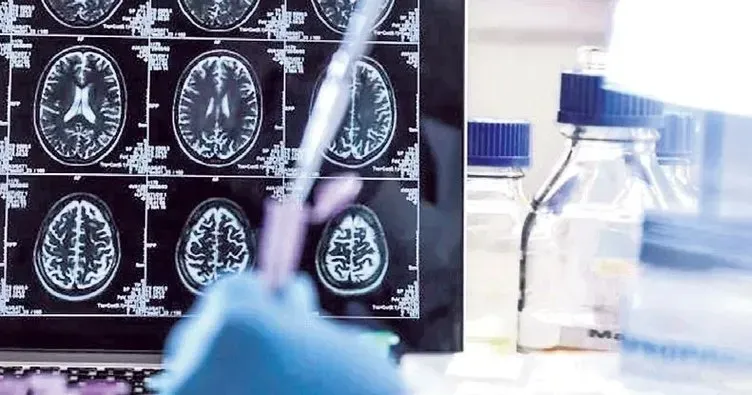 Alzheimer Kan Testi: Erken Tanıda Yeni Dönem Başlıyor