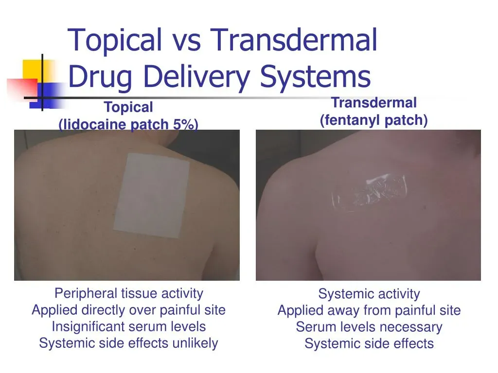 Transdermal and Topical Patch Options: A Skin Meds Guide
