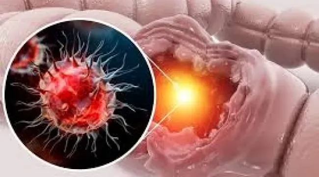 Kanser Belirti Vermeden Yayılabilir Mi? Sessiz Kanserler