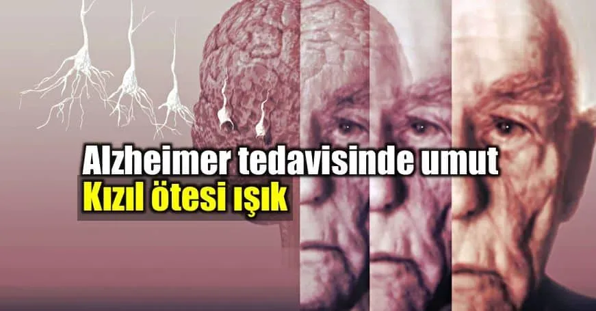 Alzheimer Tedavisi: Kanser İlaçlarından Yeni Umut